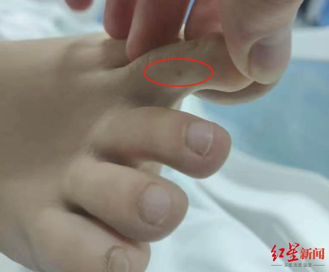 kaiyun网站：介入调查“27岁女子三亚旅游疑被不明物咬伤身亡”事件家属：未来有考虑尸检(图1)